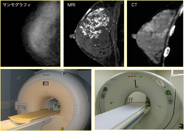 乳がんのひろがりを調べる（MRI、CT）