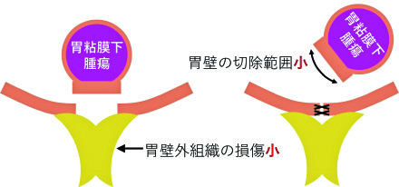 図2 EFTRの模式図