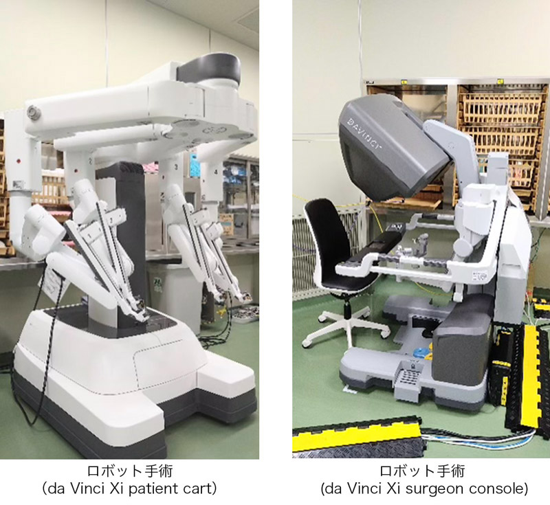 ロボット手術