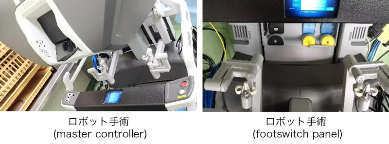 ロボット手術